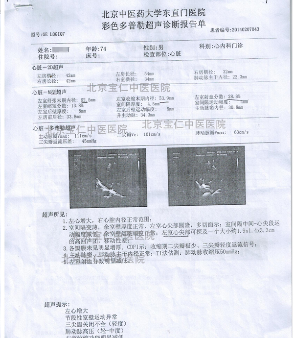 【河北 徐某 男 74岁 冠心病